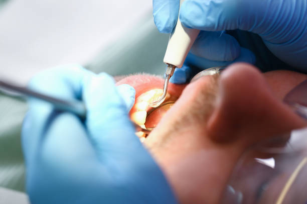Best Emergency Dental Care for Broken or Chipped Teeth in Mcconnellsburg, PA