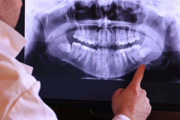 Best Emergency Tooth Extraction in Mcconnellsburg, PA