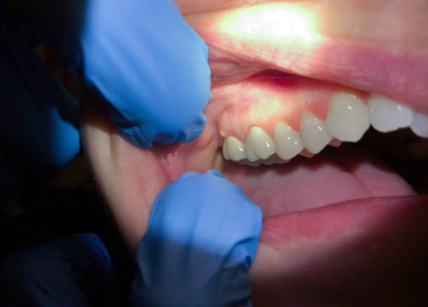 Best Emergency TMJ Treatment in Mcconnellsburg, PA