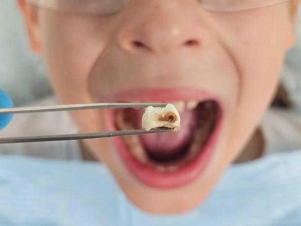 Best Cosmetic Emergency Dentistry in Mcconnellsburg, PA